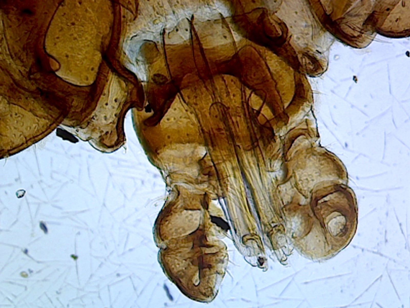 Microscope Slide, Tick, W.M.
