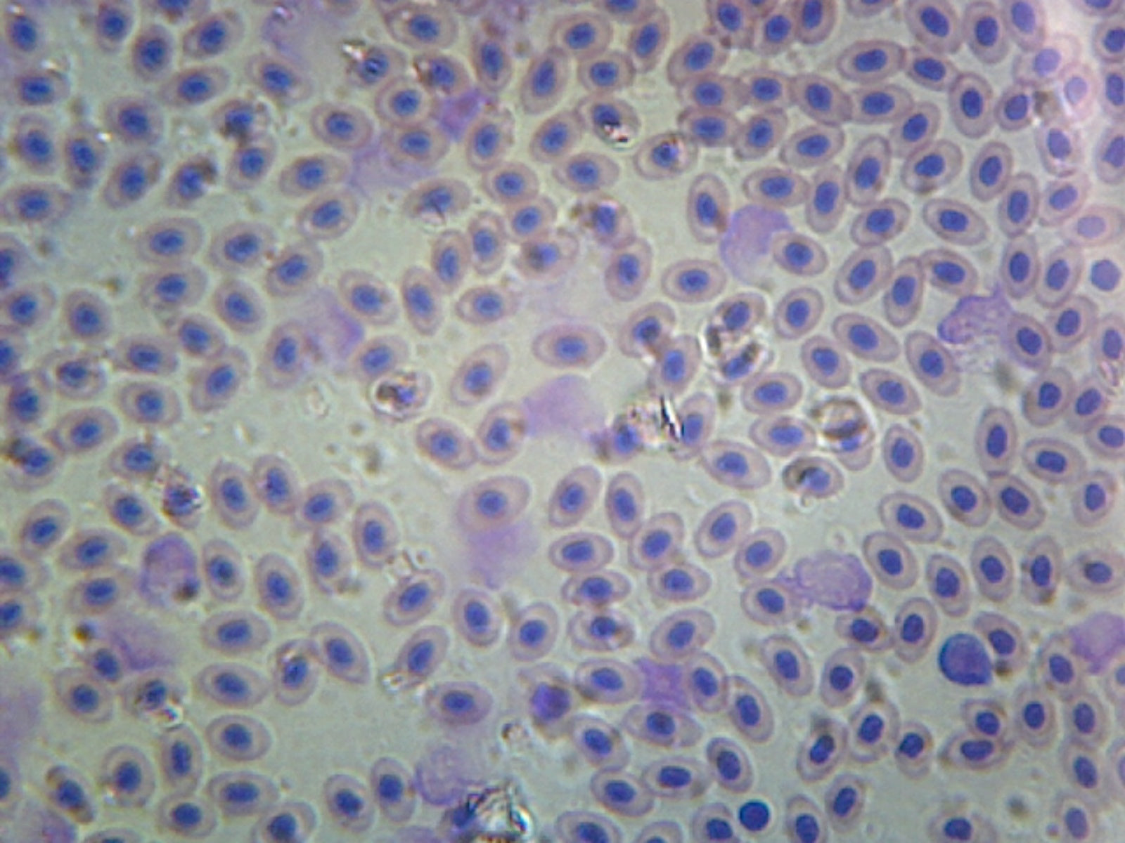 Microscope Slide, Blood Smear Bird