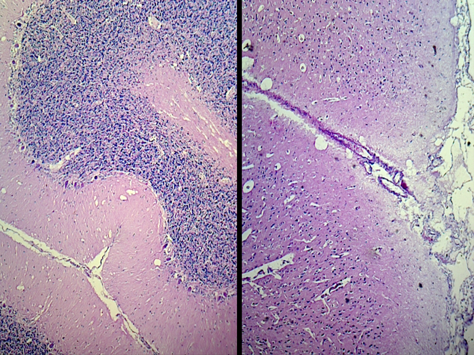 Microscope Slide, Brain Composite Sec. H&E Stain, Mammal, Showing Cerebrum and Cerebellum