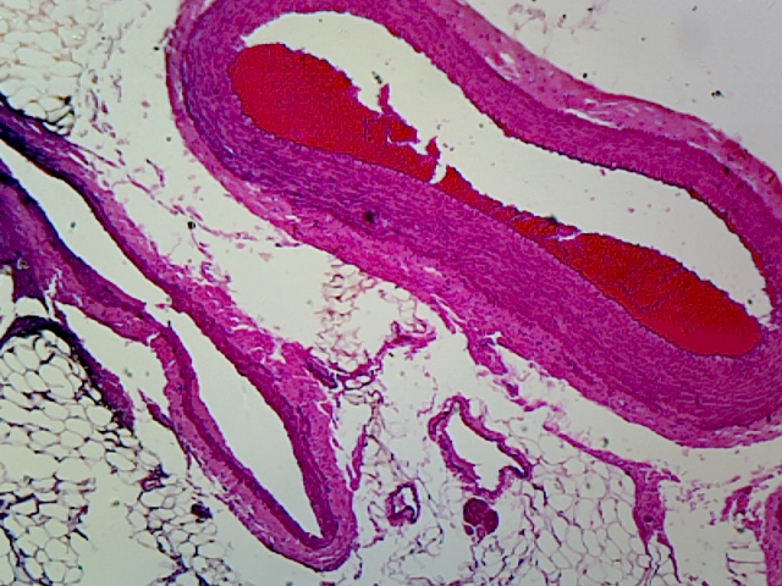Microscope Slide, Artery, Vein & Nerve C.S. Human