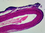 Microscope Slide, Large Sized Vein, C.S. Human vena cava