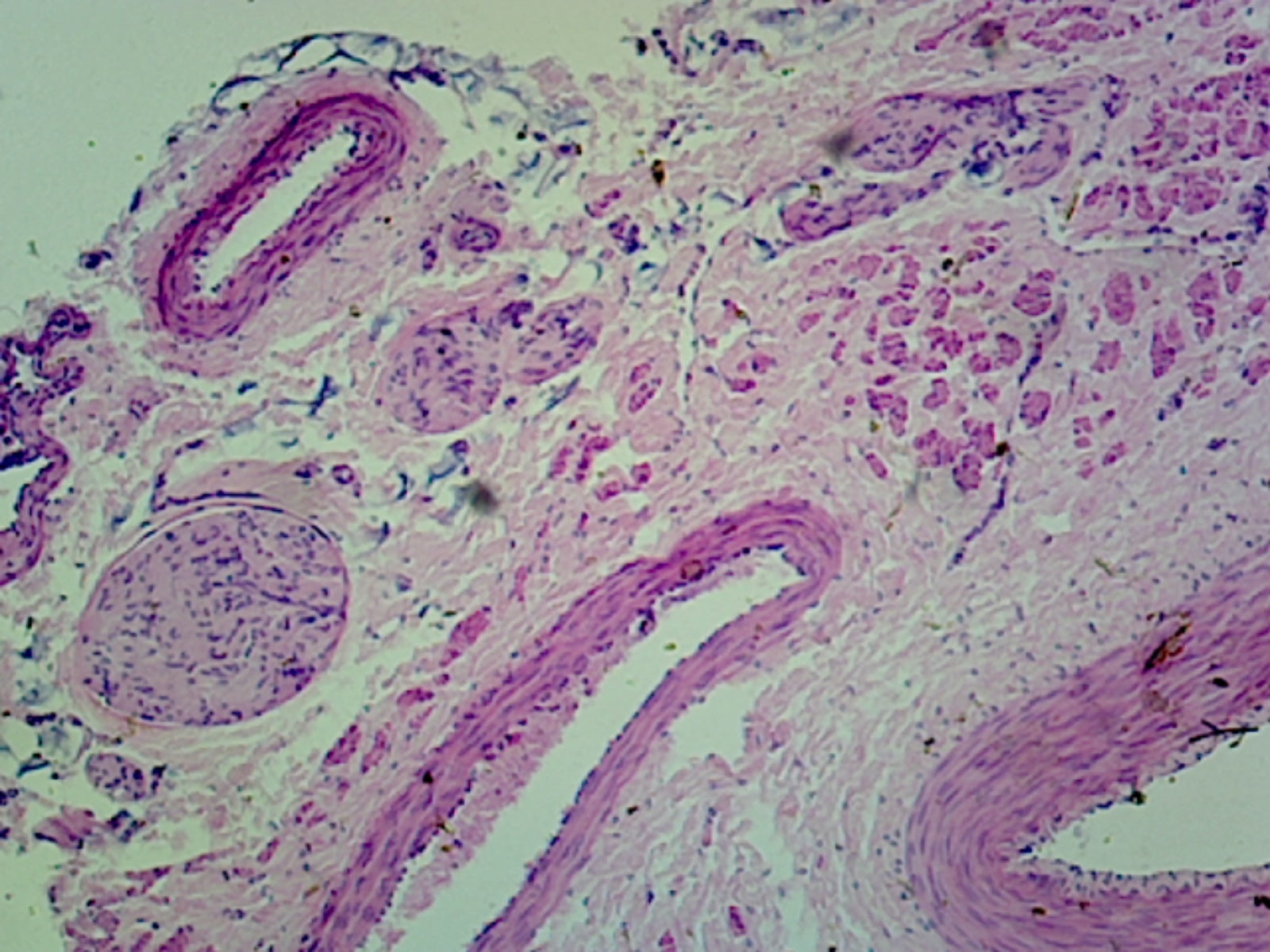 Microscope Slide, Medium Sized Artery & Vein, C.S. Human