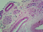 Microscope Slide, Medium Sized Artery & Vein, C.S. Human