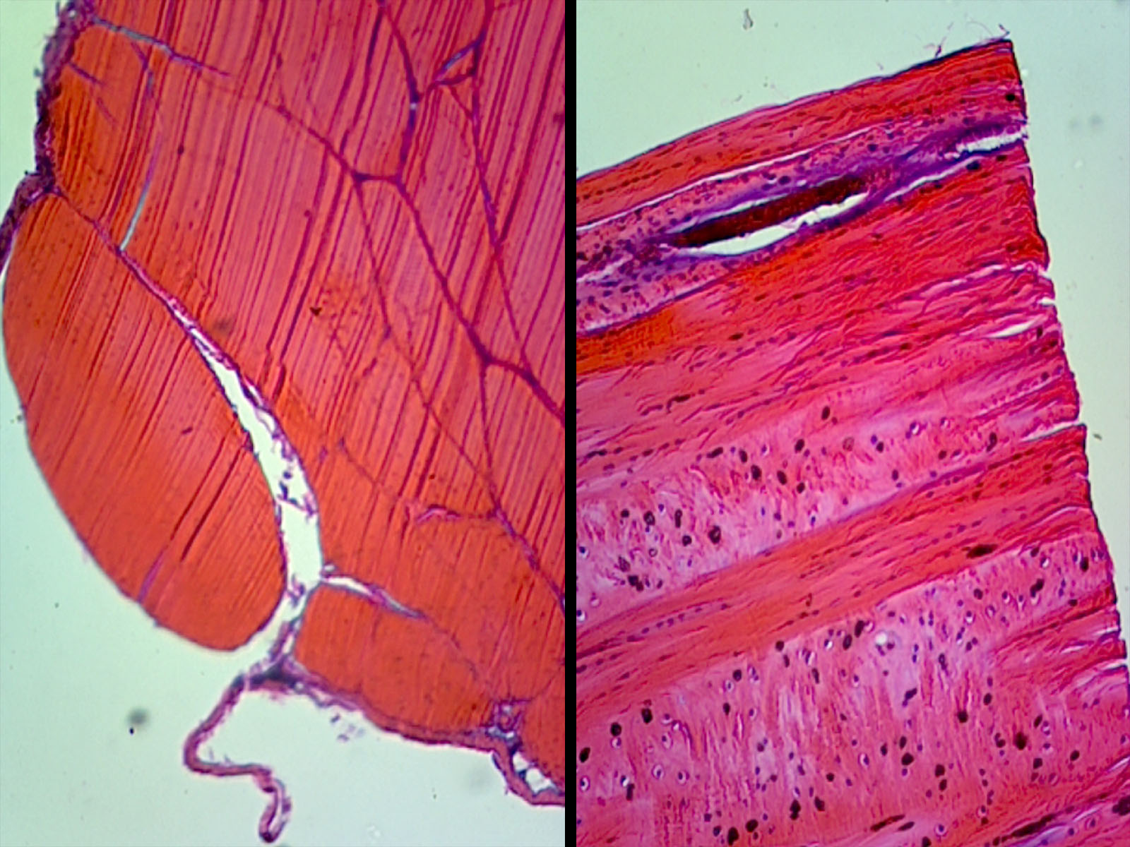 Microscope Slide, Connective Tissue, Tendon Composite, CS & LS Human