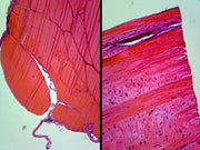 Microscope Slide, Connective Tissue, Tendon Composite, CS & LS Human