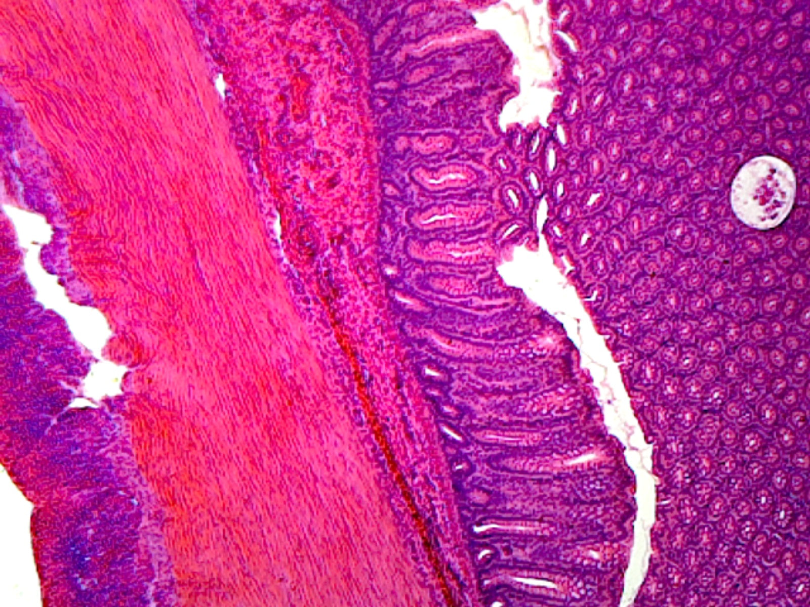 Microscope Slide, Colon, C.S. Human, showing typical histology structures