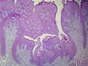 Microscope Slide, Tongue, C.S. Human. Showing general structure.