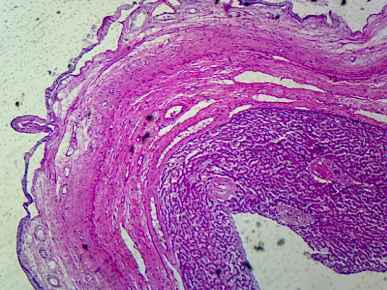 Microscope Slide, Gallbladder, Sec. Human, Showing Simple Columnar Epithelium, Serous and Muscular Layer