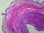 Microscope Slide, Gallbladder, Sec. Human, Showing Simple Columnar Epithelium, Serous and Muscular Layer