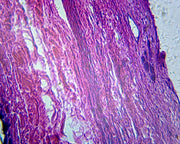 Microscope Slide, Digestive System, Gallbladder; Section