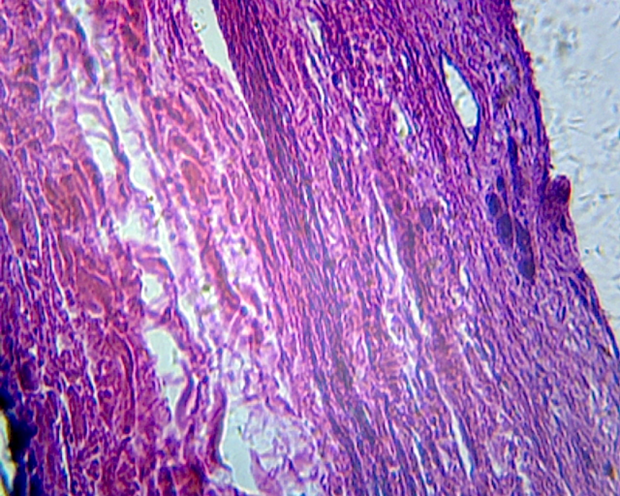 Microscope Slide, Digestive System, Gallbladder; Section