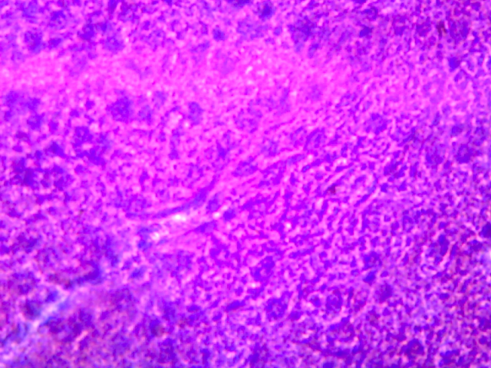Microscope Slide, Liver section H/E stain, Human, showing hepatic cells