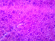 Microscope Slide, Liver section H/E stain, Human, showing hepatic cells