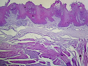 Microscope Slide, Digestive System, Tongue, L.S. Human