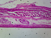 Microscope Slide, Esophagus Epithelium C.S.
