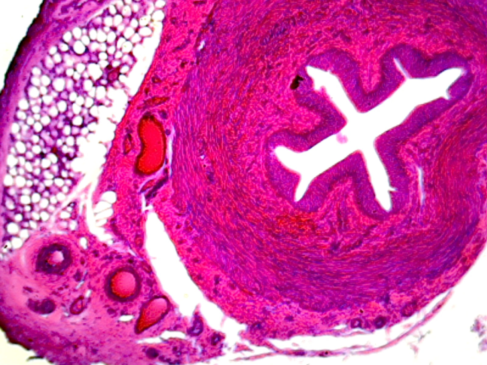 Microscope Slide, Excretory System, Ureter, C.S. Human, showing tissue layers