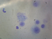 Microscope Slide, Female Chromosomes Smear Human