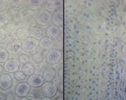 Microscope Slide, Genetic Cell Division, Ascaris & Onion Mitosis, Section, showing animal and plant mitosis in comparison