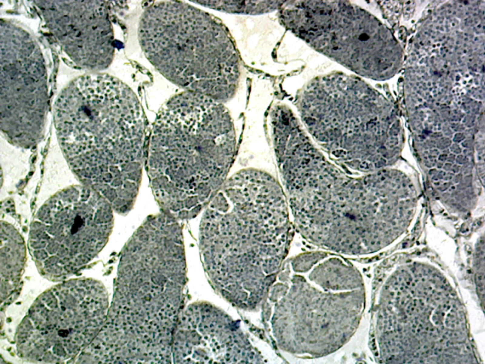 Microscope Slide, Genetic Cell Division, Grasshopper Meiosis, section showing various stages of meiosis from a grasshopper testis