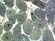 Microscope Slide, Genetic Cell Division, Grasshopper Meiosis, section showing various stages of meiosis from a grasshopper testis