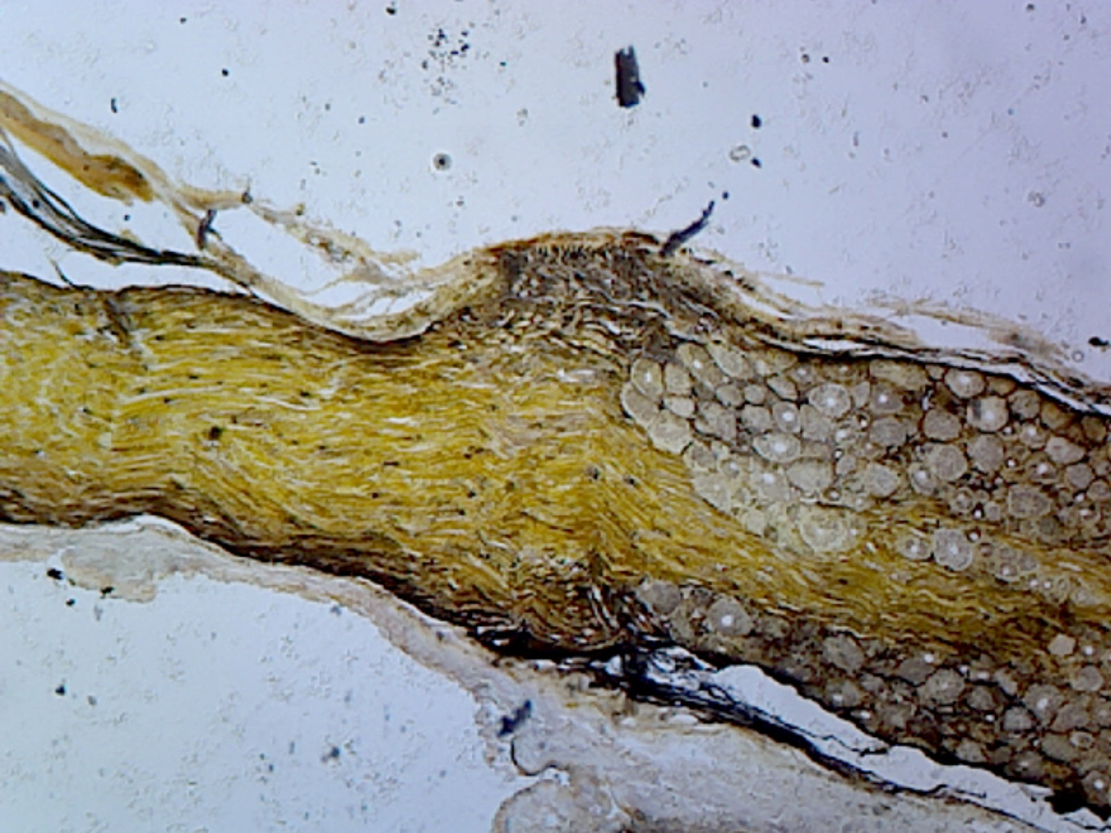 Microscope Slide, Golgi Complex, Section; from Mammalian Spinal Ganglion; Cellular Organelle