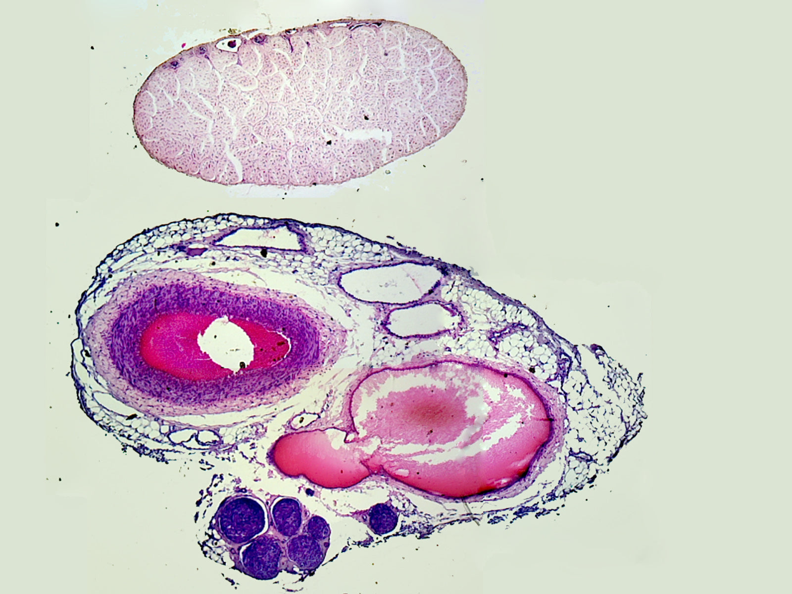 Microscope Slide, Circulatory system; Artery, Vein & Nerve; C.S. Mammal