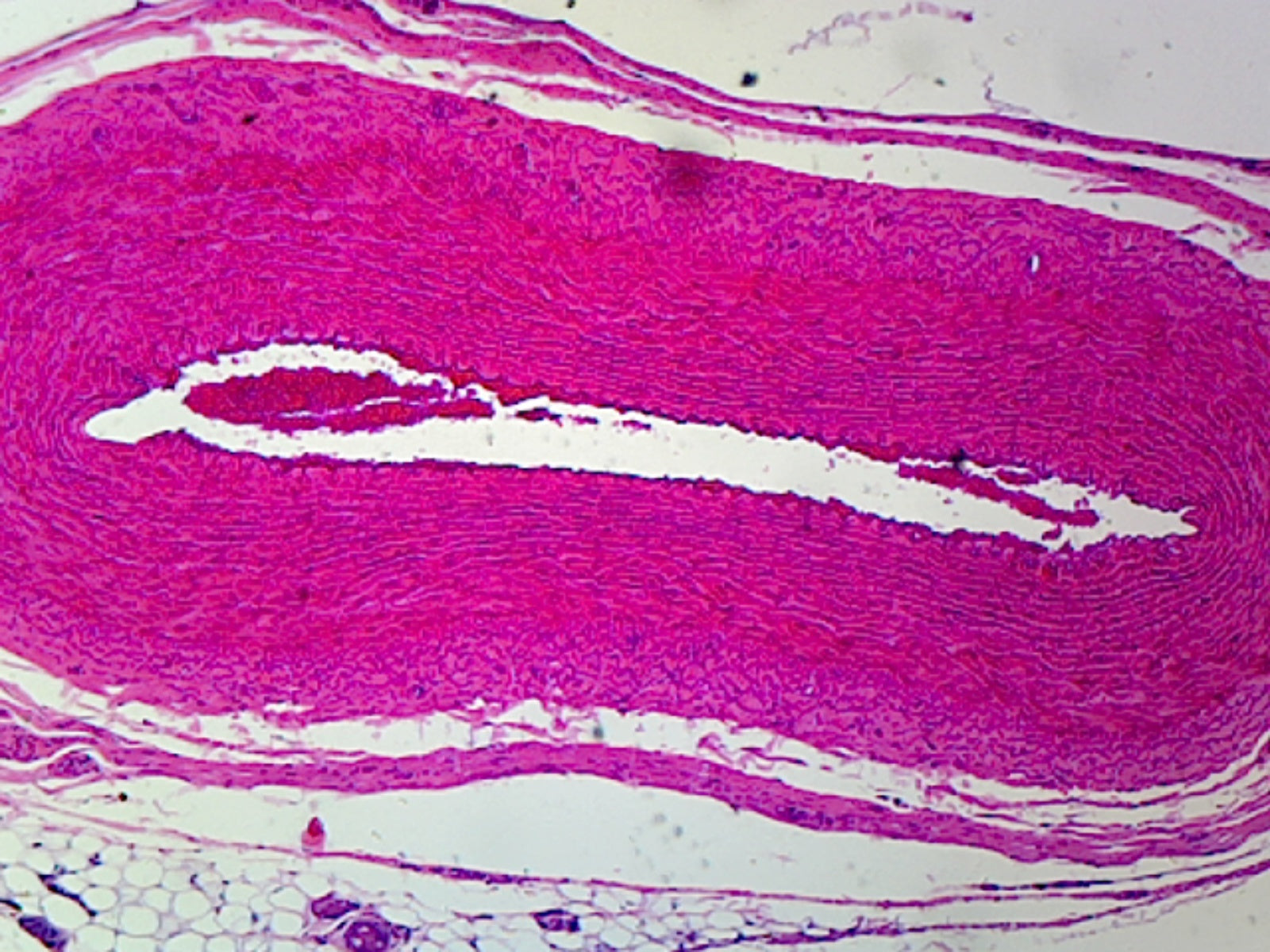 Microscope Slide, Circulatory System; Capillary, W.M., Mammal from Omentum