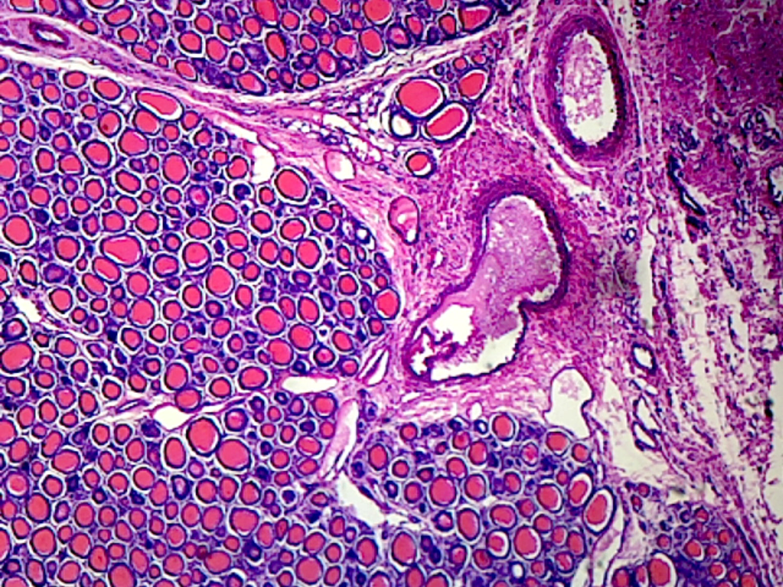 Microscope Slide, Endocrine System, Thyroid Gland Section, Mammalian