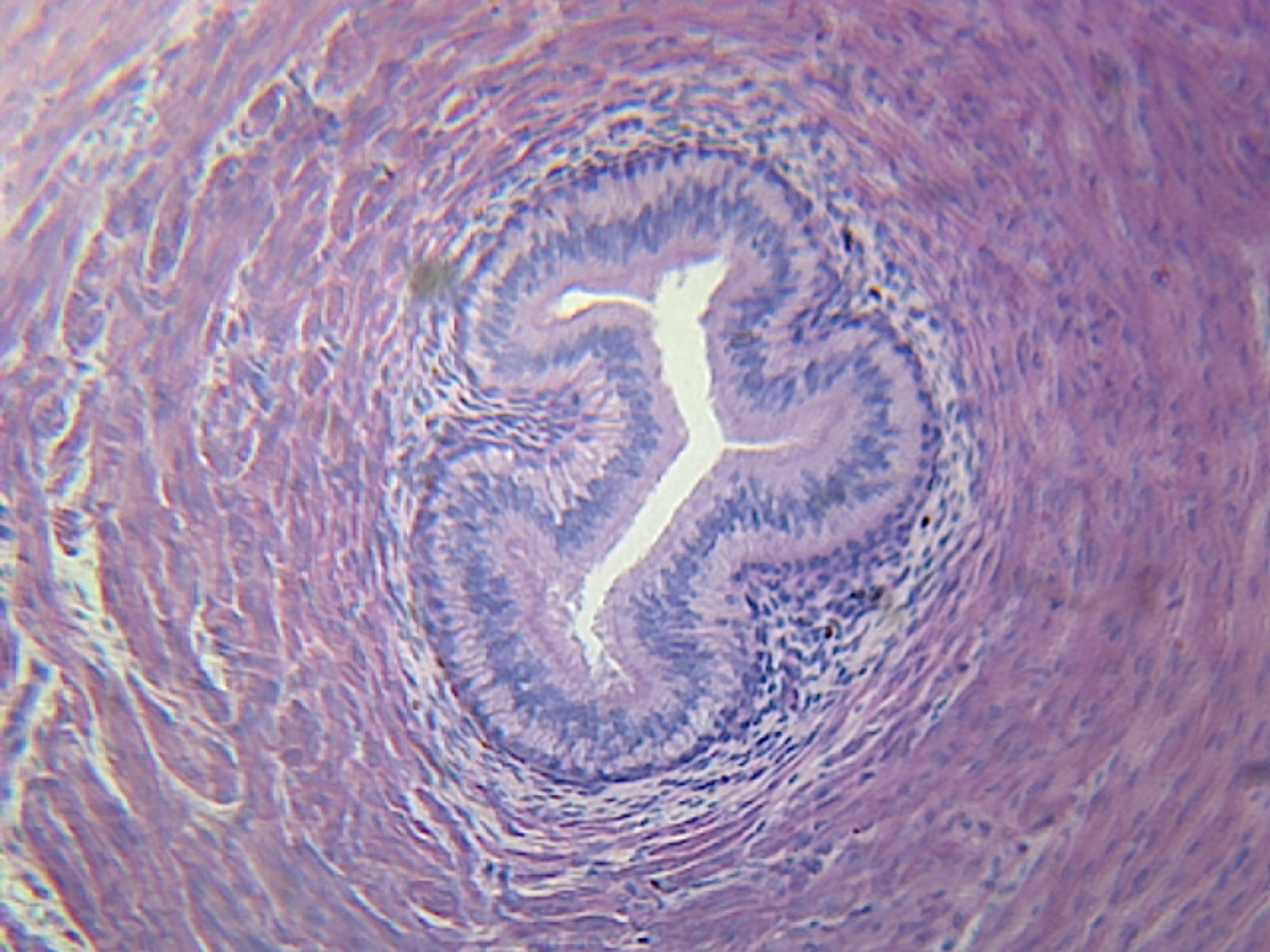 Microscope Slide, Excretory System; Ureter; C.S. Mammal Showing Tissue Layers