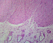Microscope Slide, Female reproductive system; Cervix Uteri; Section, Mammal, showing columnar epithelium