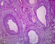 Microscope Slide, Female Reproductive System, ovarian Follicles, Section, Mammal