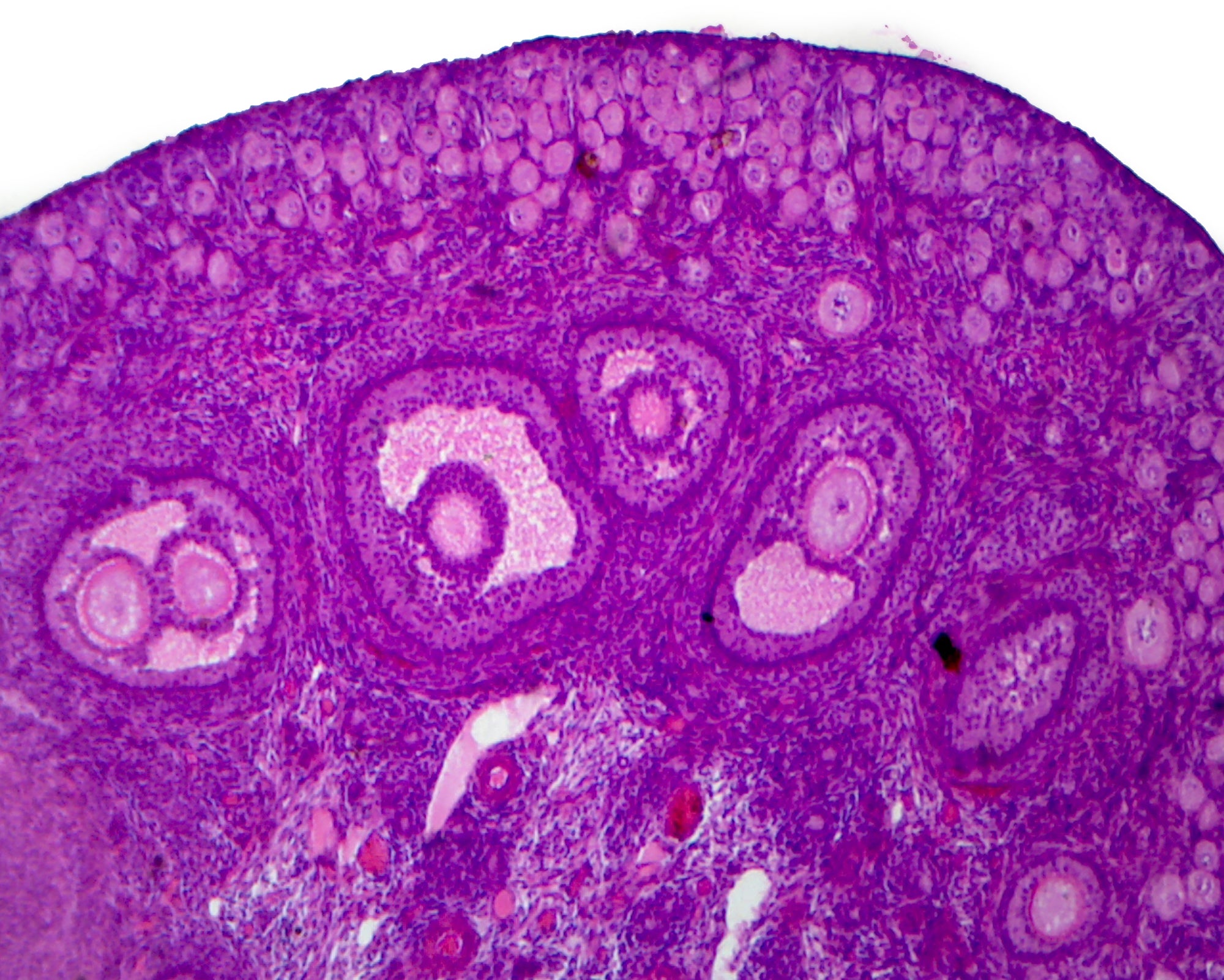 Microscope Slide, Female Reproductive System, Ovary Immature, Section, Mammal showing primary follicles