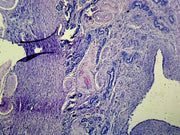 Microscope Slide, Female Reproductive System, Uterus Progravid Phase, Section, Human Showing Secretory Phase