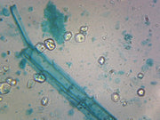 Microscope Slide, Anabaena; W.M. Blue Green Algae, Filamentous Cyanobacteria, Shows Heterocysts and Spores
