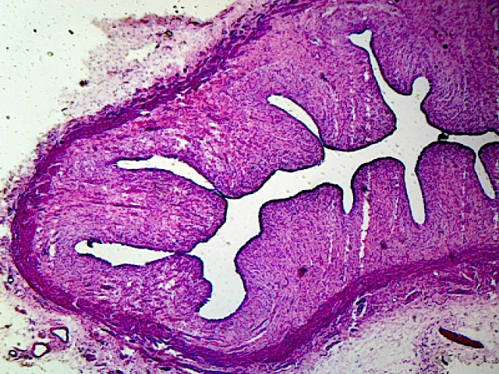 Microscope Slide, Female Reproductive System, Vaginal Section, Mammal, Showing Cornified Squamous Epithelium
