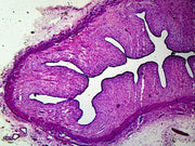 Microscope Slide, Female Reproductive System, Vaginal Section, Mammal, Showing Cornified Squamous Epithelium