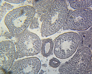 Microscope Slide, Seminal Vesicle, Section H&E Stain, Mammal