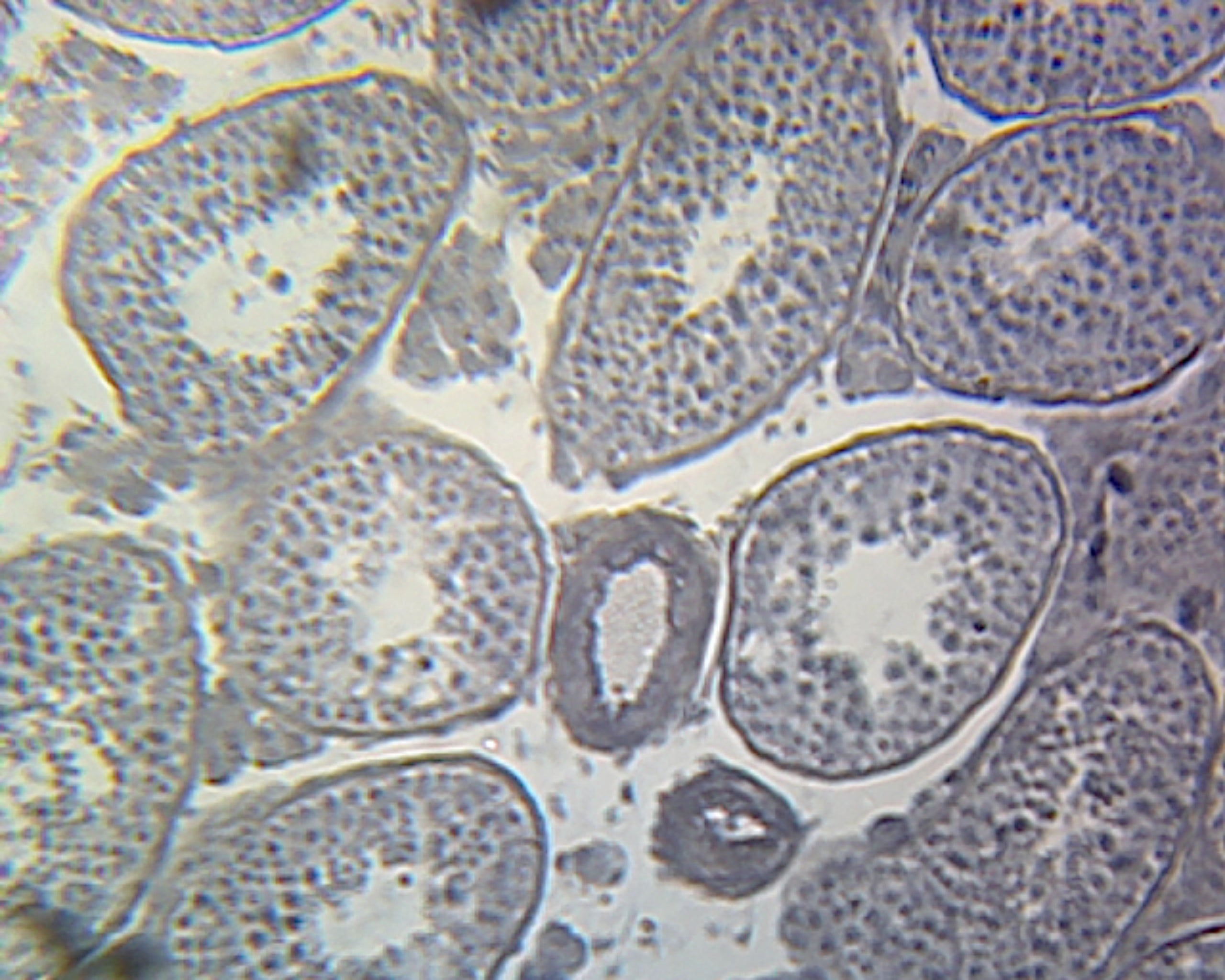 Microscope Slide, Seminal Vesicle, Section H&E Stain, Mammal