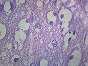 Microscope Slide, Nervous Tissue, Cerebral Cortex, Section Human