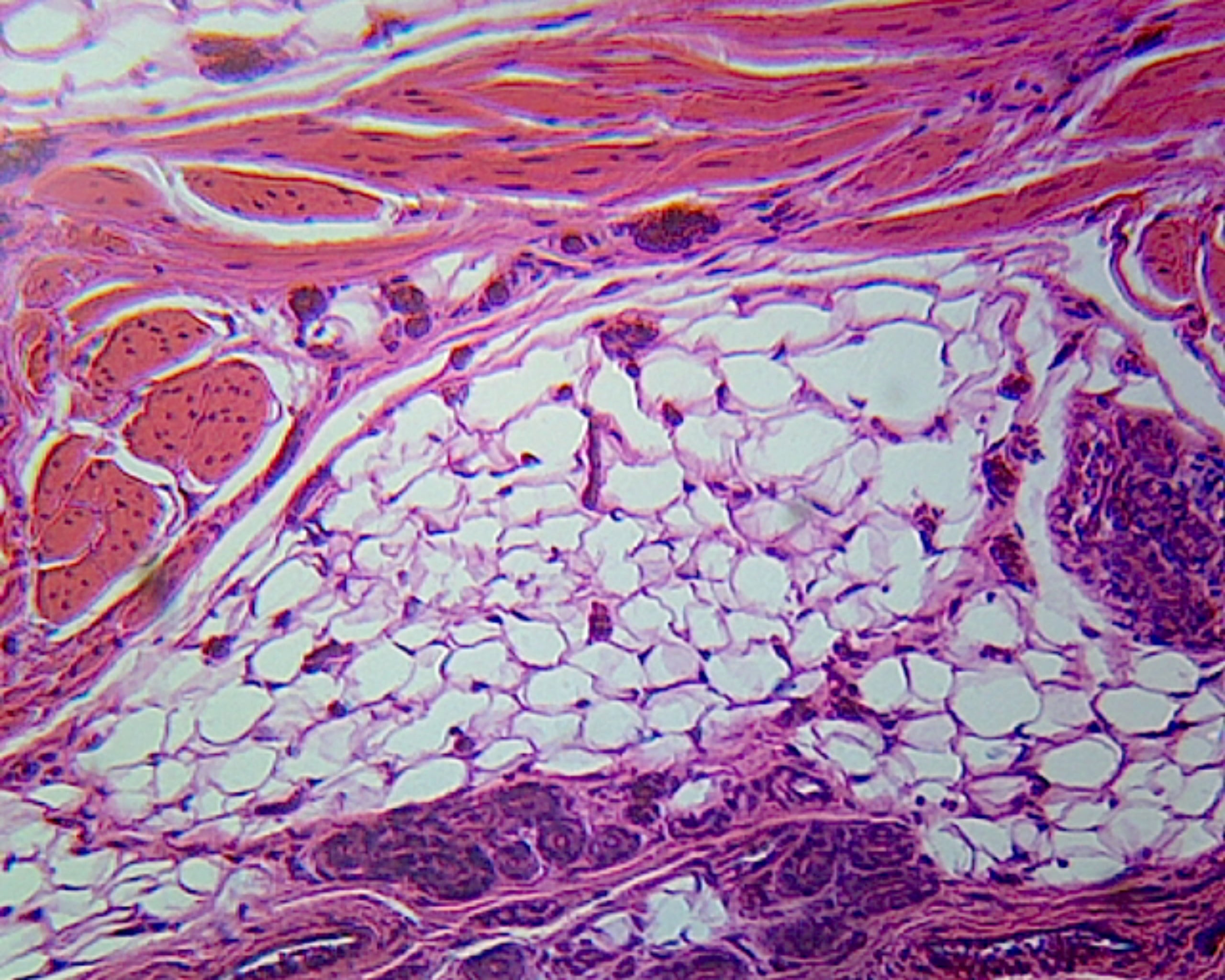 Microscope Slide, Integumentary Tissues, Human Skin, Cross Section