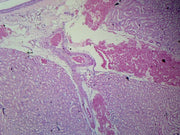Microscope Slide, Kidney. MLS Mammal, Entire Kidney Showing Renal Pelvis, Calices, Cortex and Medulla.