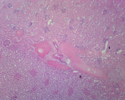Microscope Slide, Kidney Section, Human Showing Histology Structures