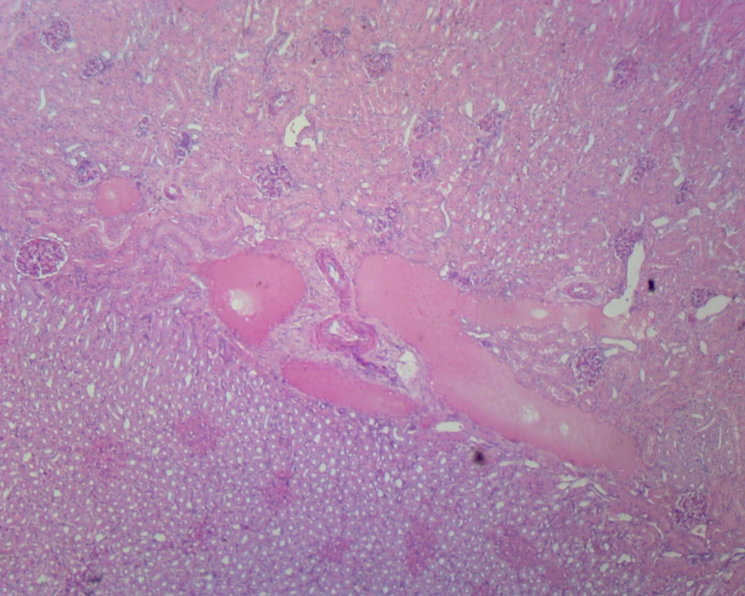 Microscope Slide, Kidney Section, Human Showing Histology Structures