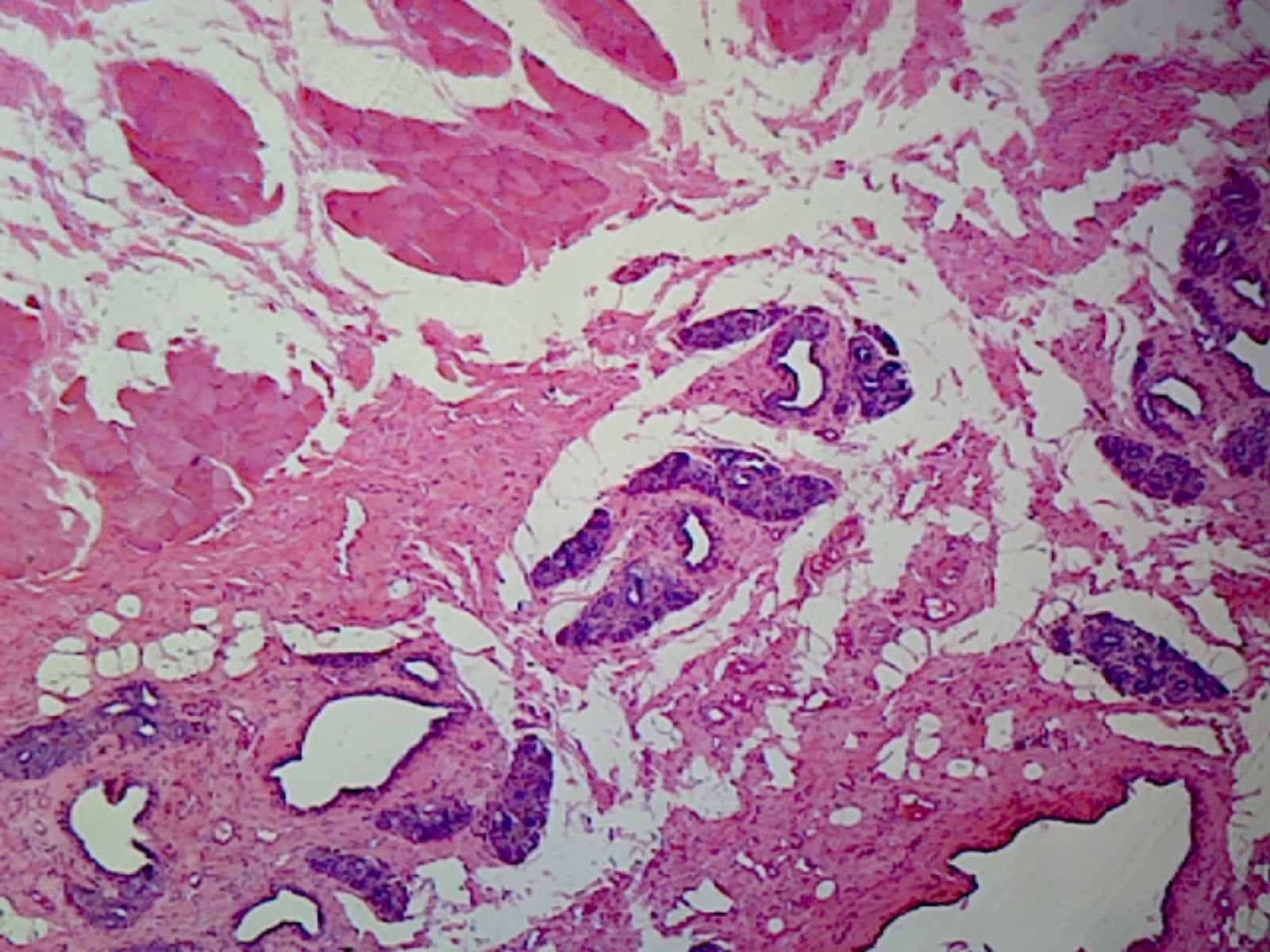 Microscope Slide, Mitochondria, Section from Pancreas or Intestine Cells, Mammalian