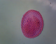 Microscope Slide, Ascaris lumbricoides eggs.