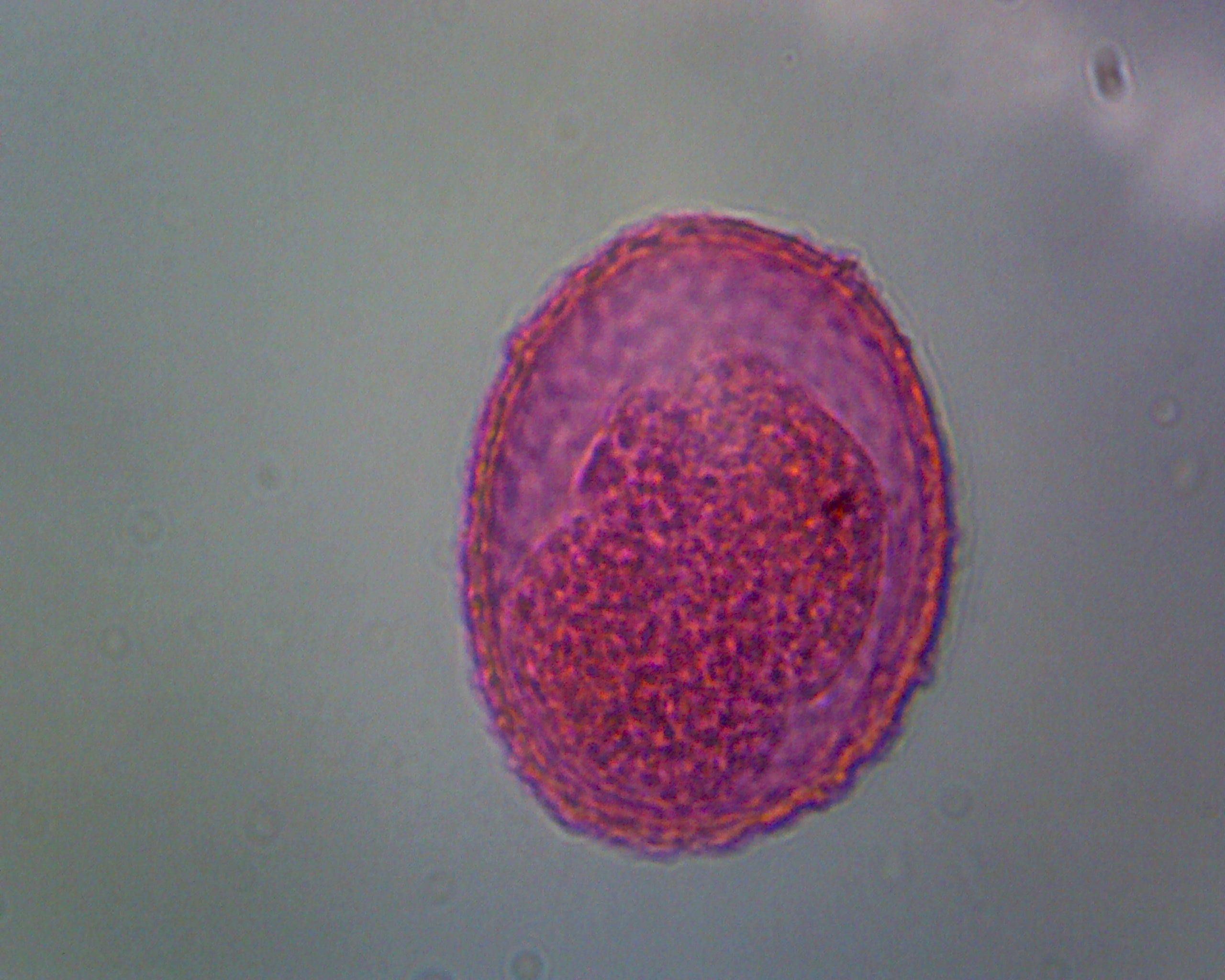 Microscope Slide, Ascaris lumbricoides eggs.