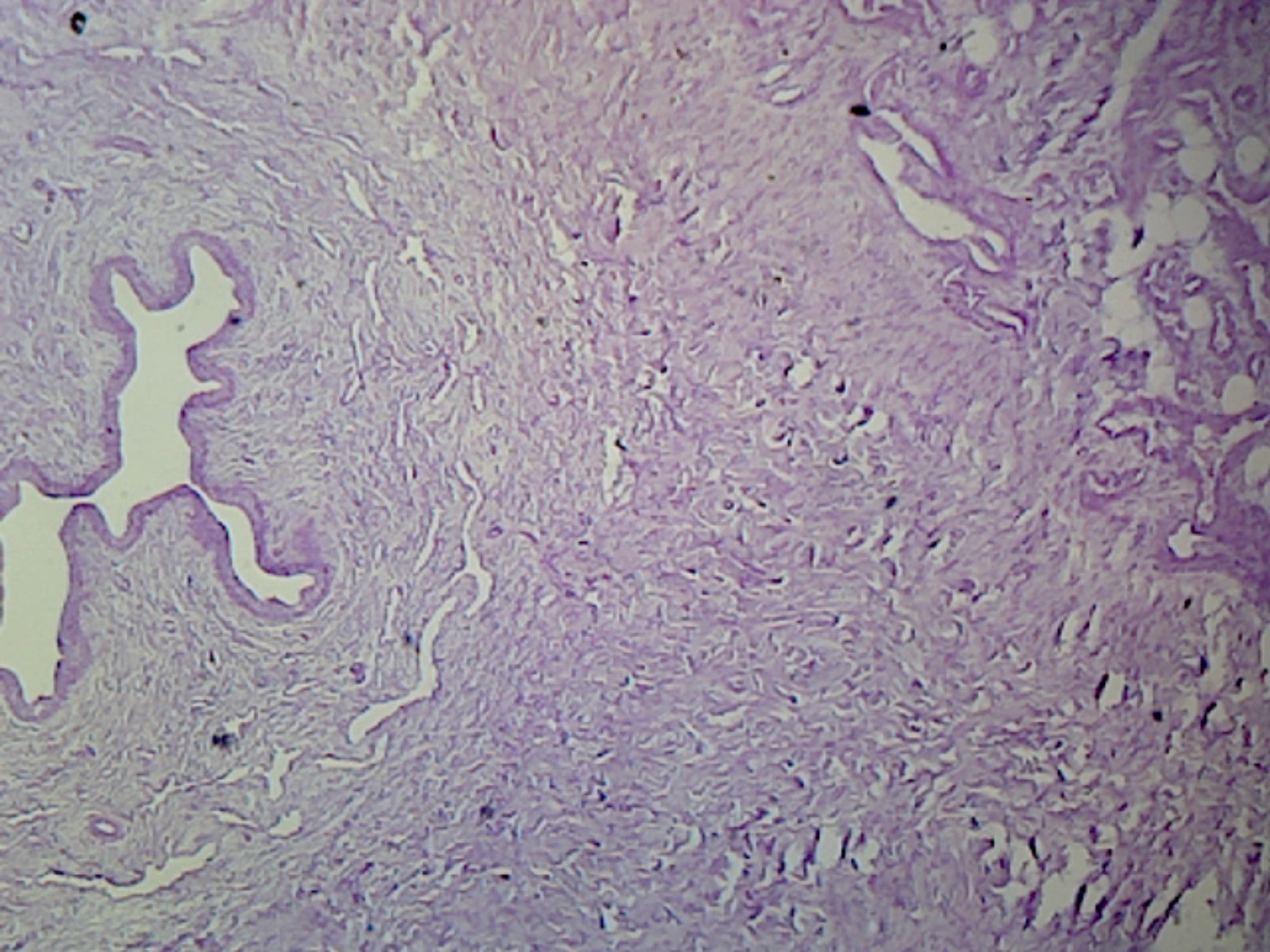 Microscope Slide, Penis C.S.; H&E Stain showing Urethra and Corpora Cavernosa