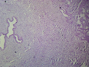 Microscope Slide, Penis C.S.; H&E Stain showing Urethra and Corpora Cavernosa