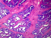 Microscope Slide, Prostate Section Human, H&E Stain, Showing Glandular Epithelium