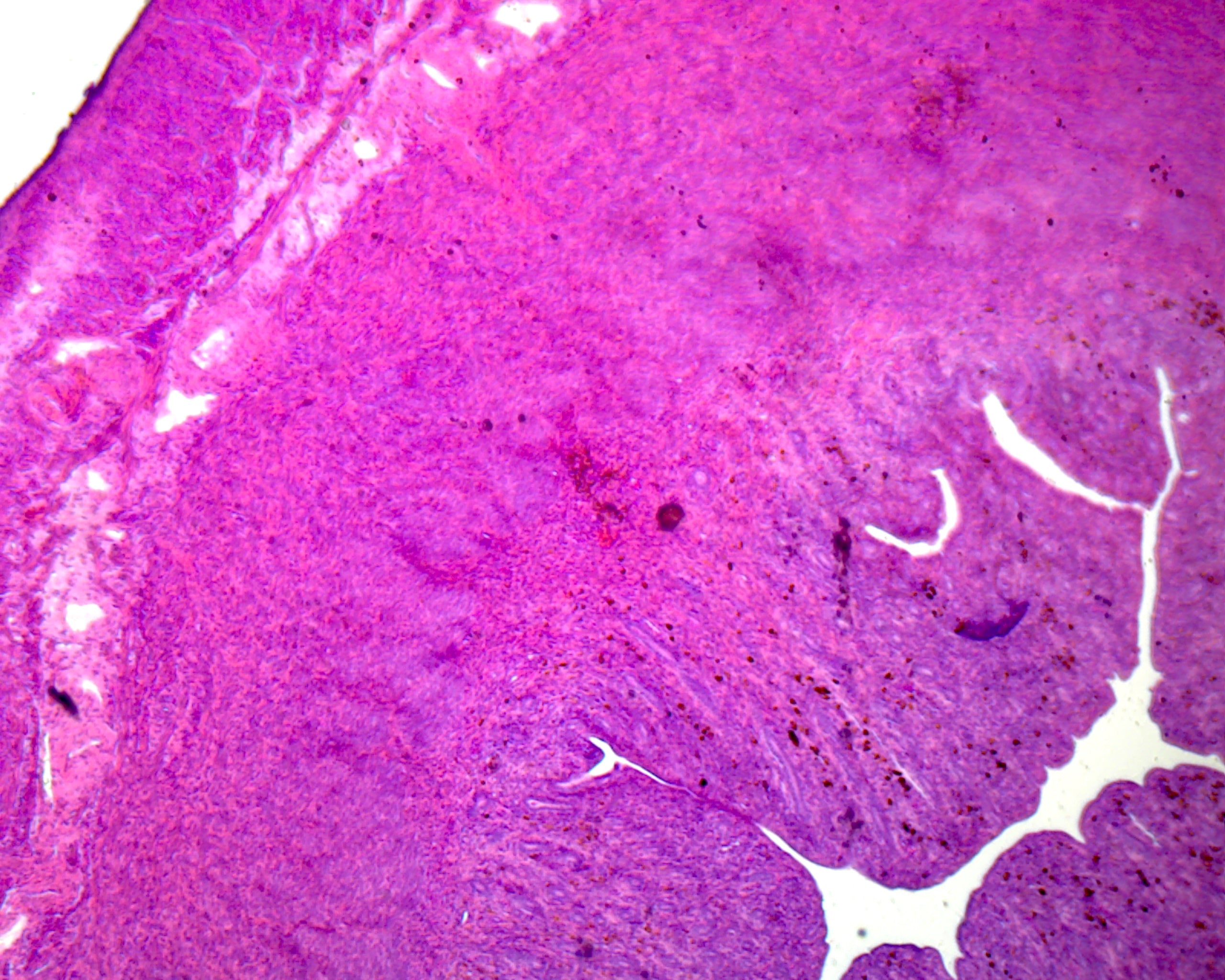 Microscope Slide, Female Uterus section, human, showing general structure